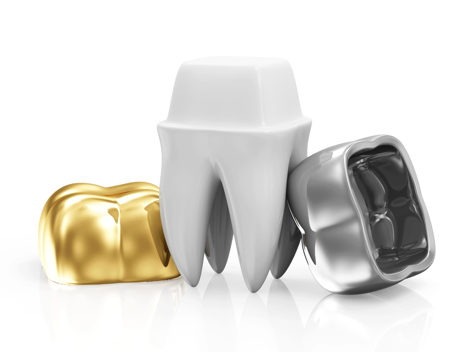 What Do Dental Crowns Look Like?